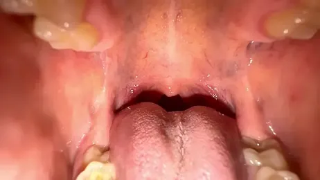 foxeslovefoxes stripchat stream image